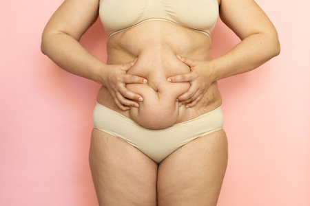 Squeeze woman sagging belly closeup, folds on tummy, loose skin and cellulite, obesity. Naked overweight plus size girl on pink background in beige underwear. Concept of dieting and body controlの写真素材