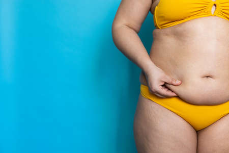 Pinch folds on woman sagging belly with hand closeup, big hips, obesity and cellulite. Overweight girl on blue background in yellow underwear, free copy space. Concept of dieting and lose weightの写真素材