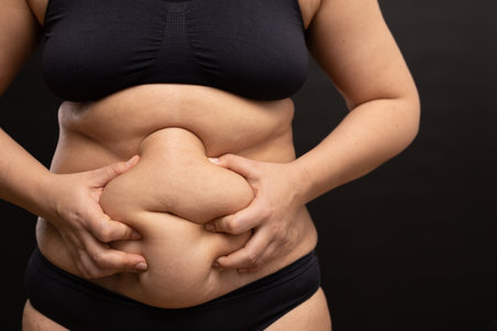 Female thick belly with fat folds closeup. Plump woman massaging stomach with hands. Body positive, self acceptance.の写真素材
