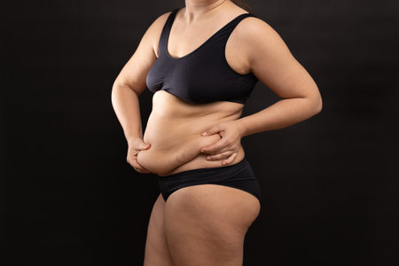 Overweight woman in black underwear massaging belly fat folds, side view. Flaunt figure imperfections, cellulite body.の写真素材