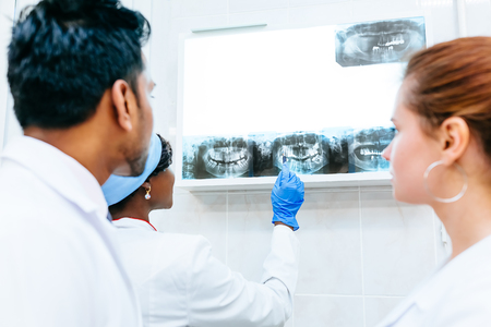 Multiracial dental team checking teeth x ray of patient. Dental clinic concept.の写真素材