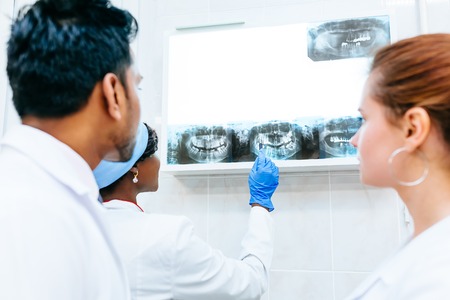 Multiracial dental team checking teeth x ray of patient. Dental clinic concept.の写真素材