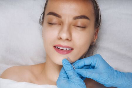 Facial Beauty Injections. Portrait Beautiful Young Woman Receiving Hyaluronic Acid Injection. Closeup Of Hands In Gloves Holding Syringe Near Attractive Female Face.の写真素材