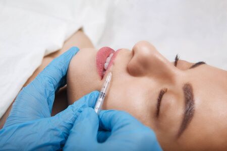 Facial Beauty Injections. Portrait Beautiful Young Woman Receiving Hyaluronic Acid Injection. Closeup Of Hands In Gloves Holding Syringe Near Attractive Female Face.の写真素材