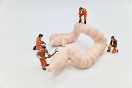 Miniature people : Workers repairing human intestine on white background, health concept