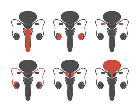 Set of male human reproductive system with different organs marked with red color. Medical...