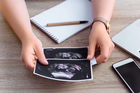 cropped view of female hands holding ultrasound scan of unborn babyの写真素材