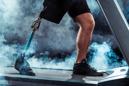 partial view of sportsman with leg prosthesis training on treadmillの写真素材