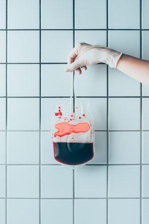 cropped shot of doctor in glove holding plastic bag with blood for transfusion in front of tiled white wallの写真素材