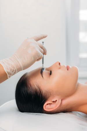 partial view of cosmetologist putting needle on womans forehead during acupuncture therapy in spa salonの写真素材