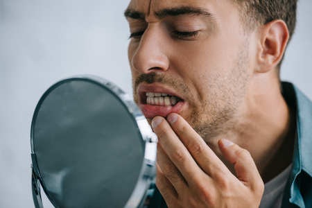 close-up view of young man with tooth pain looking at mirrorの写真素材