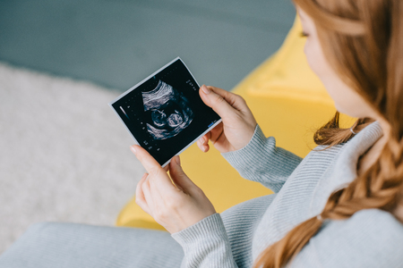cropped image of attractive pregnant woman looking at ultrasound scan in living roomの写真素材