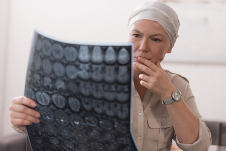 serious sick mature woman in kerchief holding mri scanの写真素材