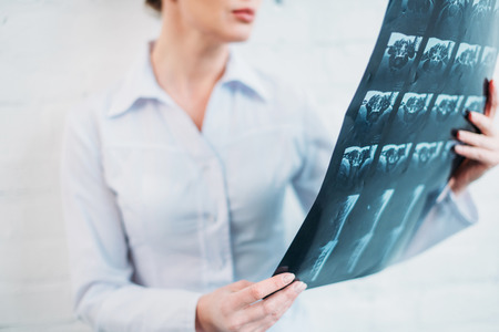 Cropped shot of female doctor examining MRI scanの写真素材
