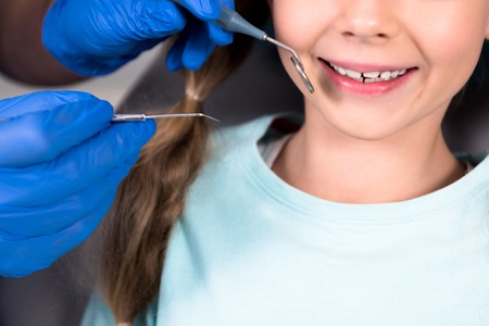 Cropped shot of dentist with tools examining teeth of smiling little childの写真素材