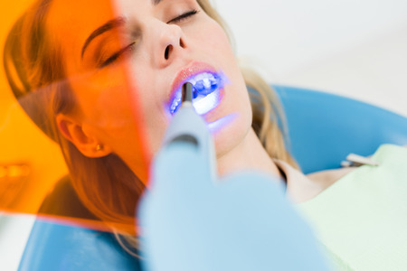 Female patient at dental procedure using uv lamp in modern dental clinicの写真素材