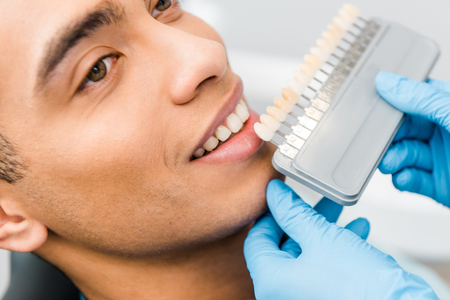 close up of cheerful african american man smiling near teeth color paletteの写真素材