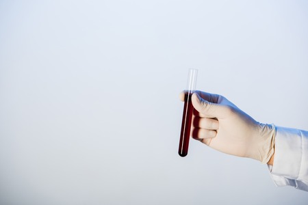 Cropped view of doctor holding test tube with blood on blue background