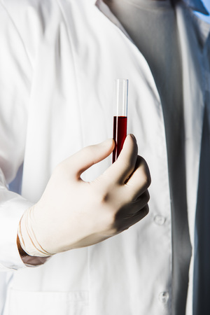 Cropped view of doctor in medical glove holding test tube with blood