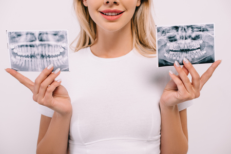cropped view of smiling woman in t-shirt holding teeth x-rays isolated on whiteの写真素材