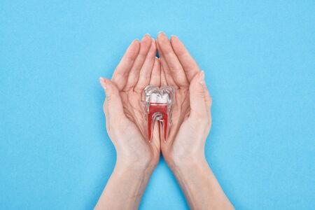 cropped view of woman holding tooth model with red dental root isolated on blue