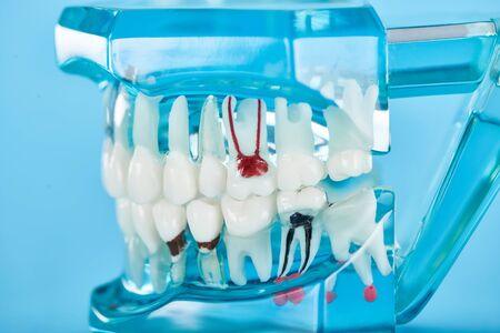 selective focus of teeth model with red dental roots in white teeth isolated on blue