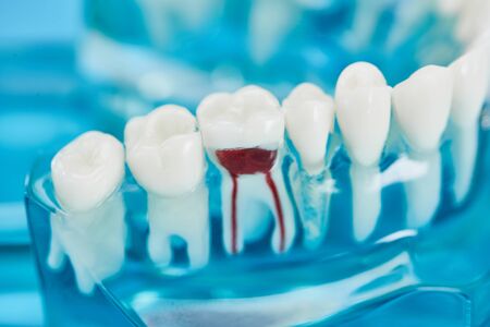 selective focus of teeth model with white teeth and red dental root