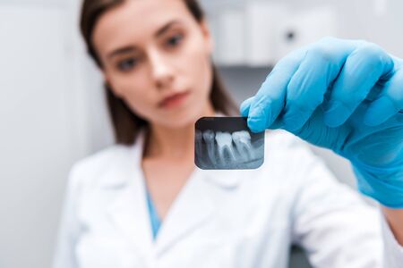 selective focus of x-ray in hand on attractive dentist