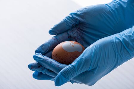 cropped view of doctor in latex gloves holding egg with baby silhouette