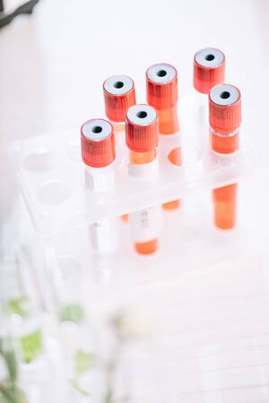 selective focus of red test tubes with samples