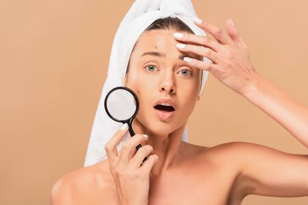 shocked young woman with pimples on face holding magnifier isolated on beigeの写真素材