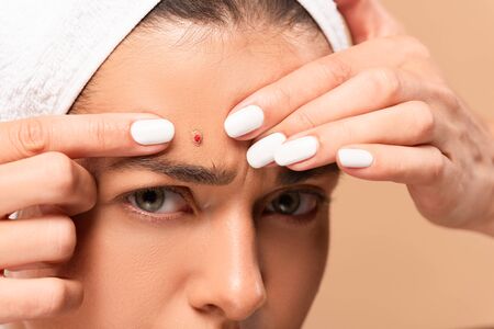 cropped view of young woman in towel squeezing pimple isolated on beige
