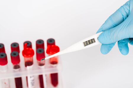 cropped view of scientist holding digital thermometer near test tubes isolated on whiteの写真素材