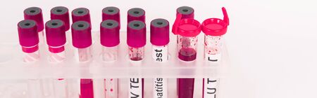 panoramic shot of test tubes with samples isolated on white