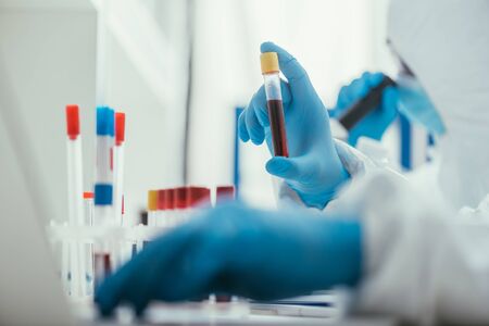 selective focus of biochemist holding test tube with blood sample near colleague