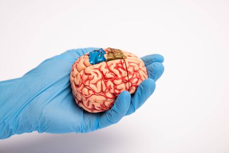 High angle view of doctor holding brain model with colored parts on white background, alzheimer...