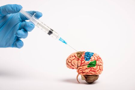 Cropped view of doctor holding syringe near brain model on white background, alzheimer disease conceptの写真素材
