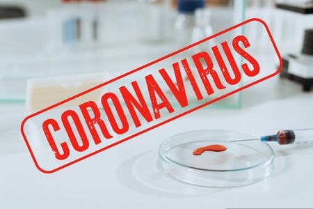 selective focus of syringe and petri dish with blood sample near white mouse in glass box, coronavirus illustrationの写真素材