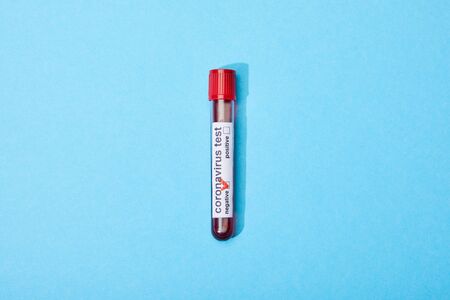 top view of test tube with blood sample and coronavirus test lettering on blue