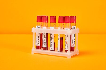 test tubes with blood samples and coronavirus test lettering on orangeの写真素材