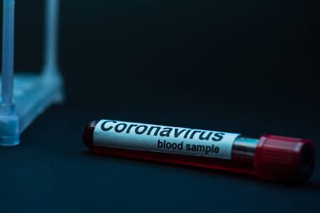 Selective focus of sample tube with coronavirus blood sample on darkの写真素材