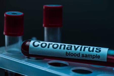 Selective focus of sample tube with coronavirus blood sample lettering on test tube rack on darkの写真素材