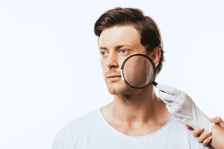 Young man looking away while dermatologist in latex glove holding loupe isolated on whiteの写真素材