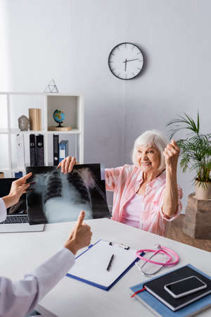 Elderly woman with yes gesture holding x-ray near doctor with thumb upの写真素材