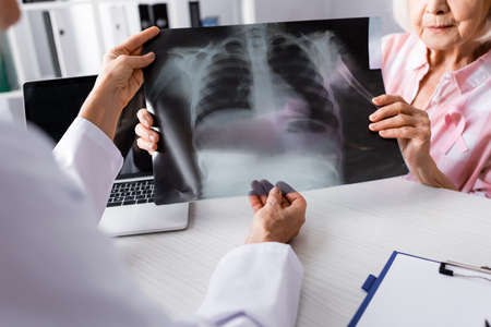 Cropped view of patient with pink ribbon and doctor holding x-ray near laptop