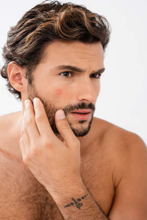 Worried man with acne on cheek isolated on grayの写真素材