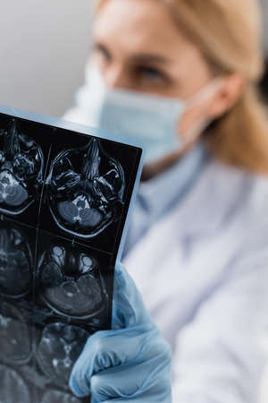 x-ray near scientist in medical mask on blurred background