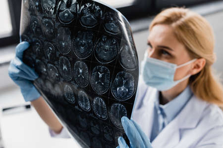 x-ray in hands of scientist in medical mask and latex gloves on blurred backgroundの写真素材