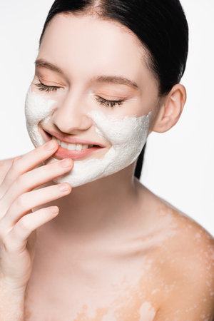 smiling young beautiful woman with vitiligo and clay mask on face isolated on whiteの写真素材