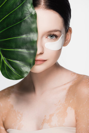 young beautiful woman with vitiligo and eye patches on face near green leaf isolated on whiteの写真素材